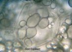 Amyloplaste
